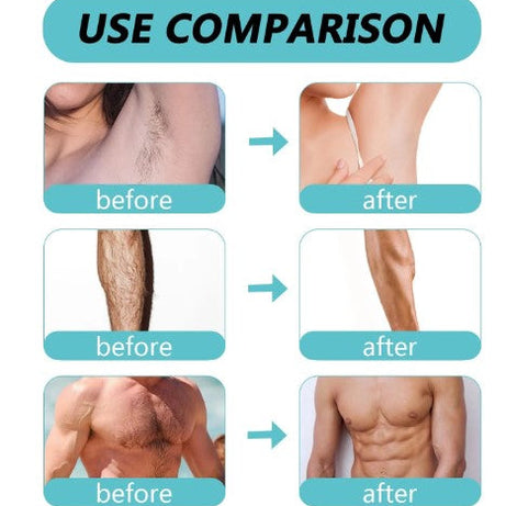 Imported Unisex Painless Ecrin Hair Removal Spray with Easy & Pain Free Hair Removal Technology