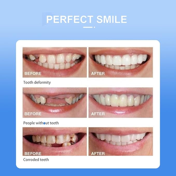 Snap On Smile Veneers Moldable False Artificial Braces Teeth Kits For Men And Women