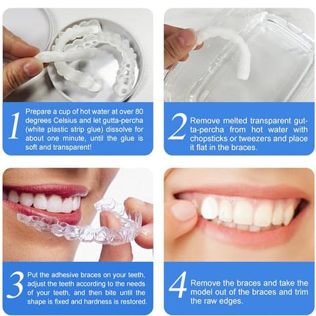 Snap On Smile Veneers Moldable False Artificial Braces Teeth Kits For Men And Women