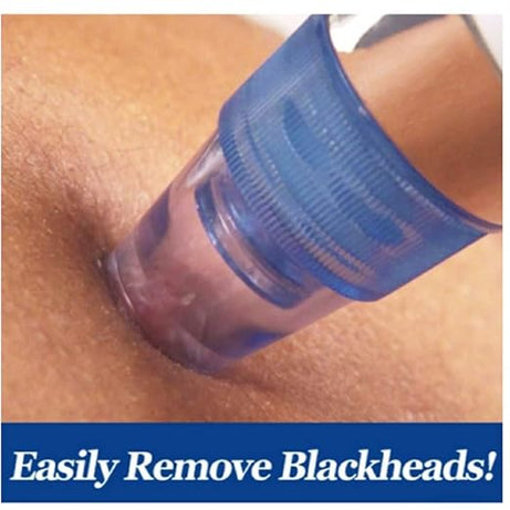 DermaSuction Multifunctional Cleaning Instrument For Pore Acne Pimple Removal and Vacuum Suction Facial Pore Cleaner Rs 1599